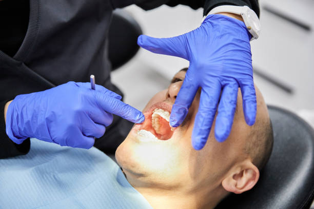 Best Emergency Root Canal Treatment in Calhoun City, MS